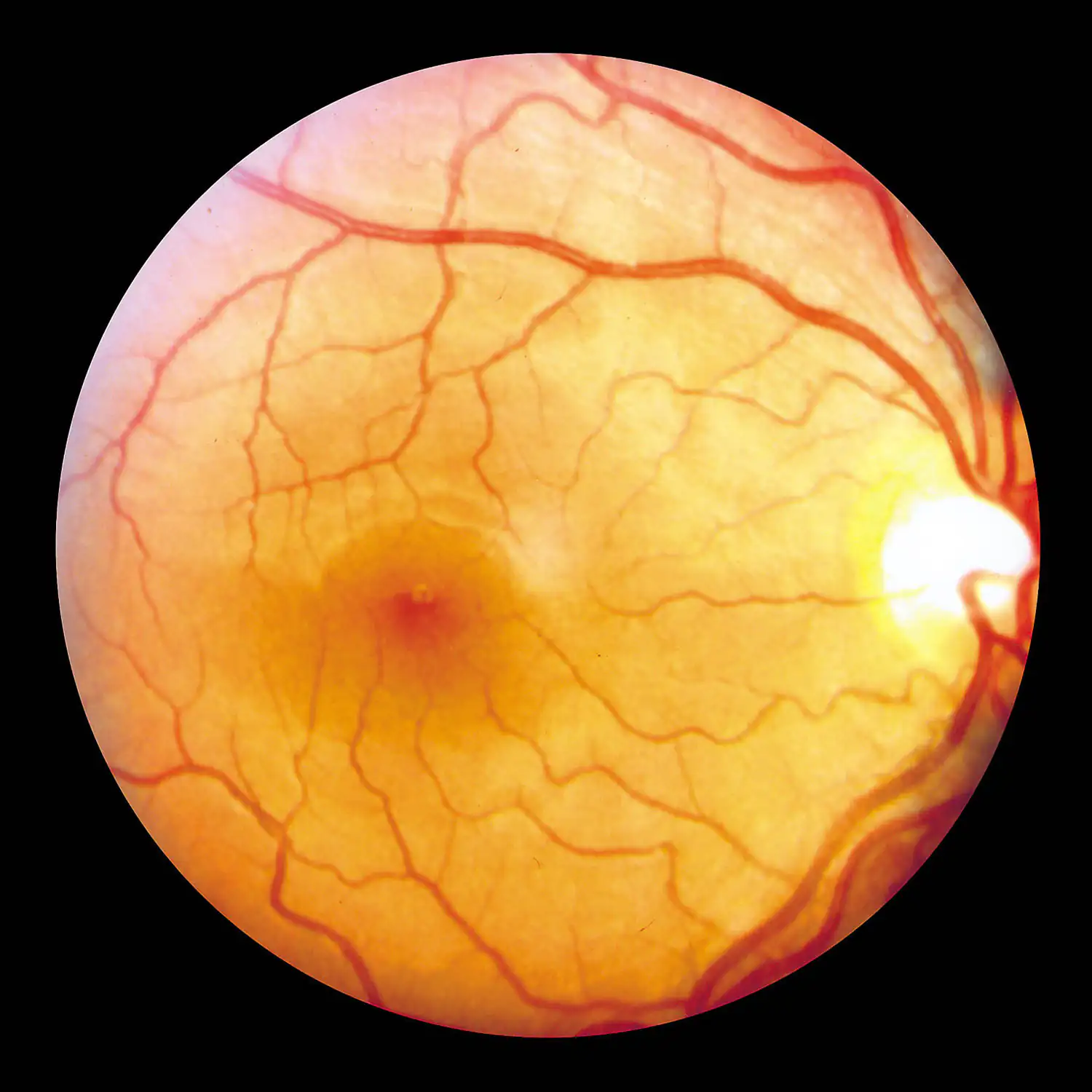 retina dell'occhio retina dell'occhio