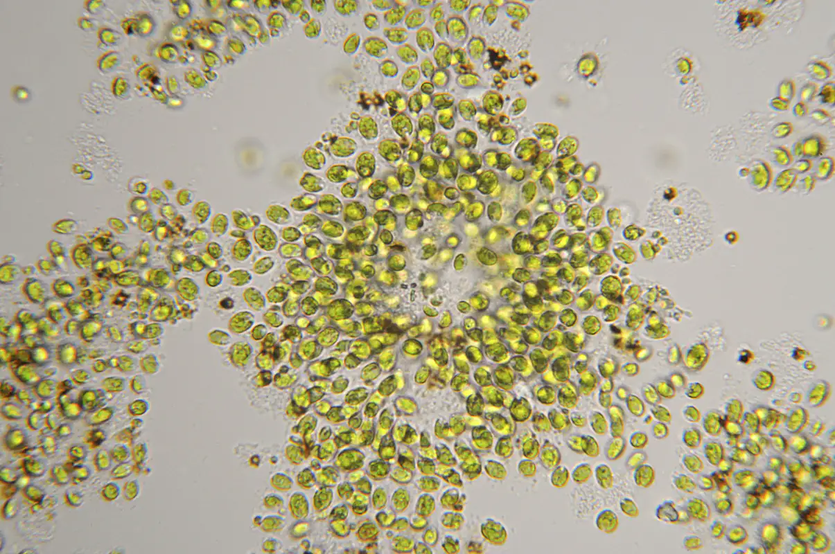 Chlorella vulgaris al microscopio Chlorella vulgaris al microscopio